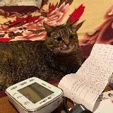 ЭКГ электрокардиография